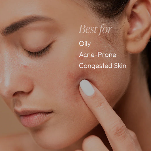Acne Essentials Kit