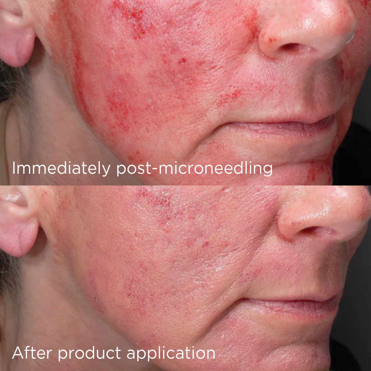 DAILY PREVENTION™ advanced smartblend mineral moisturizer SPF 75