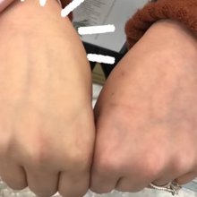 MYSKINBUDDY Boost