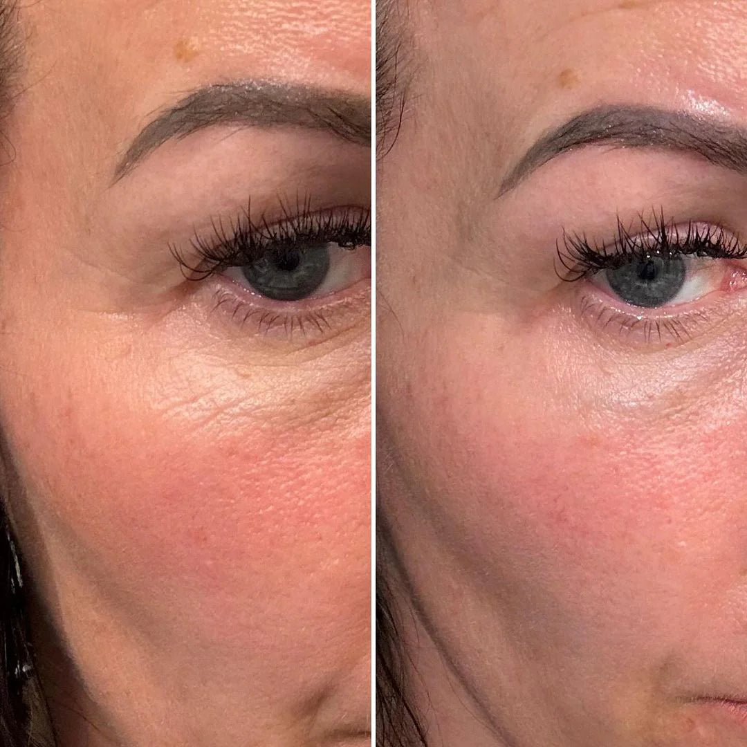 MYSKINBUDDY Boost