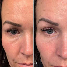 MYSKINBUDDY Boost