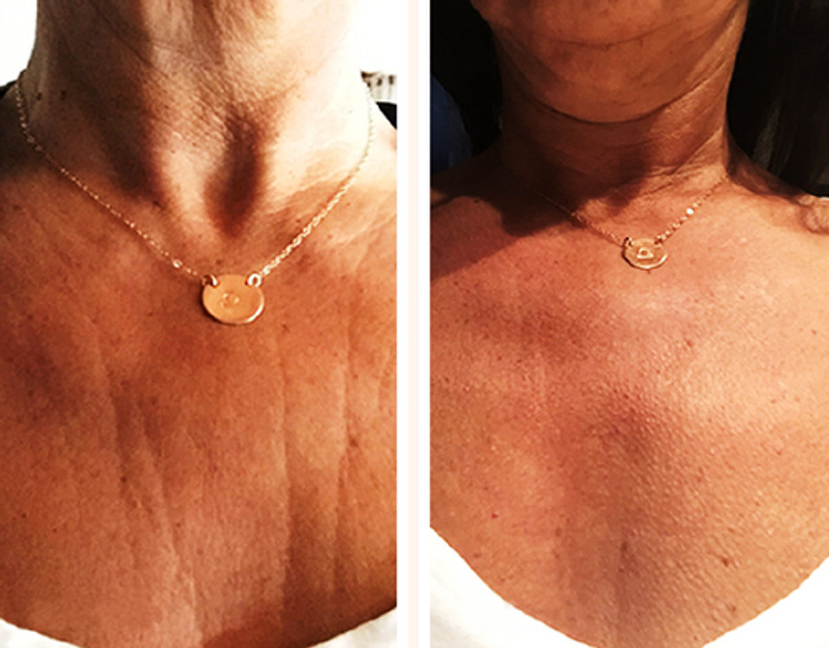 Bust Mask Skin Plumping Reusable Chest Mask ~ new look! – Relevé Aesthetics