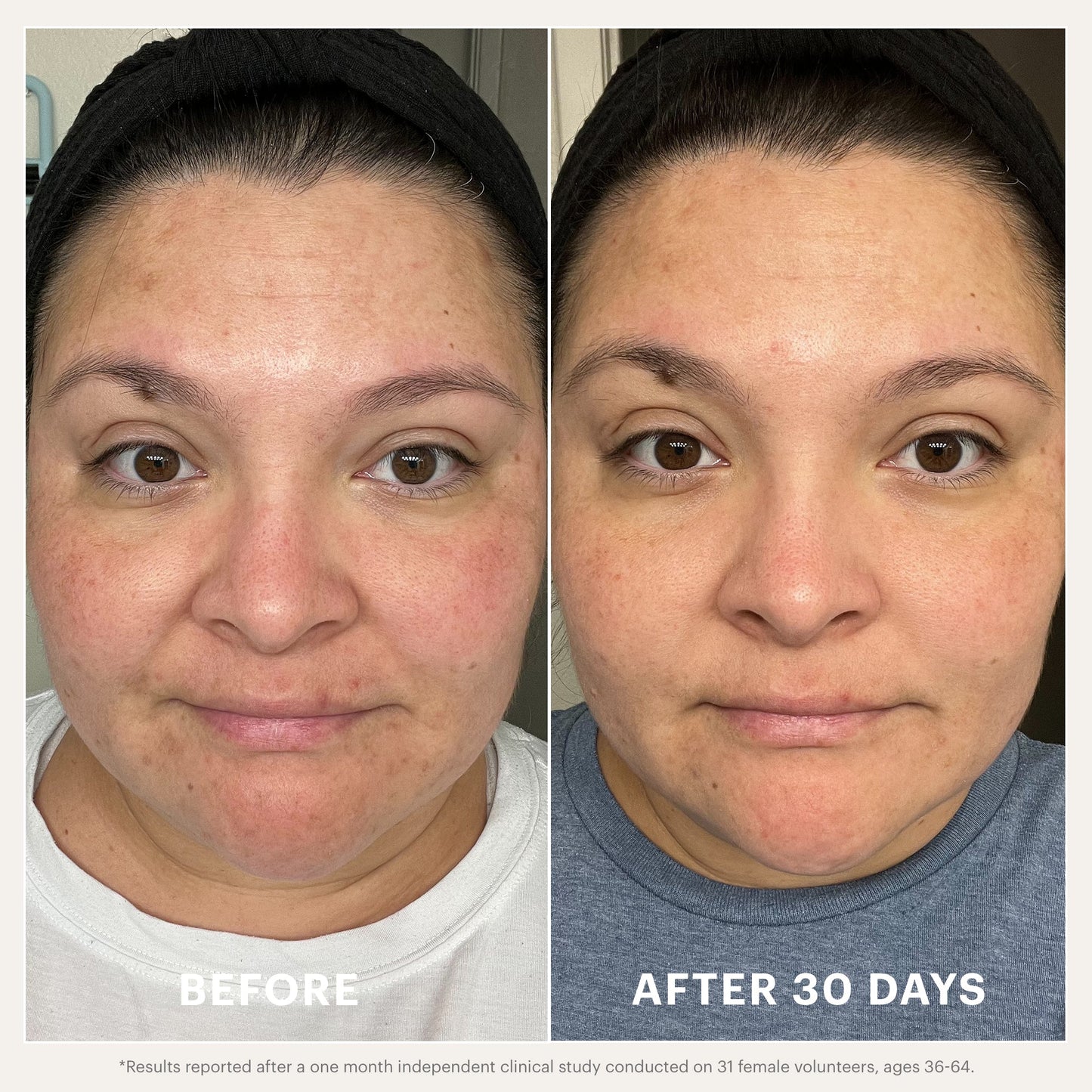 Renew Serum ~ "Beta-Clarity BHA Drops"