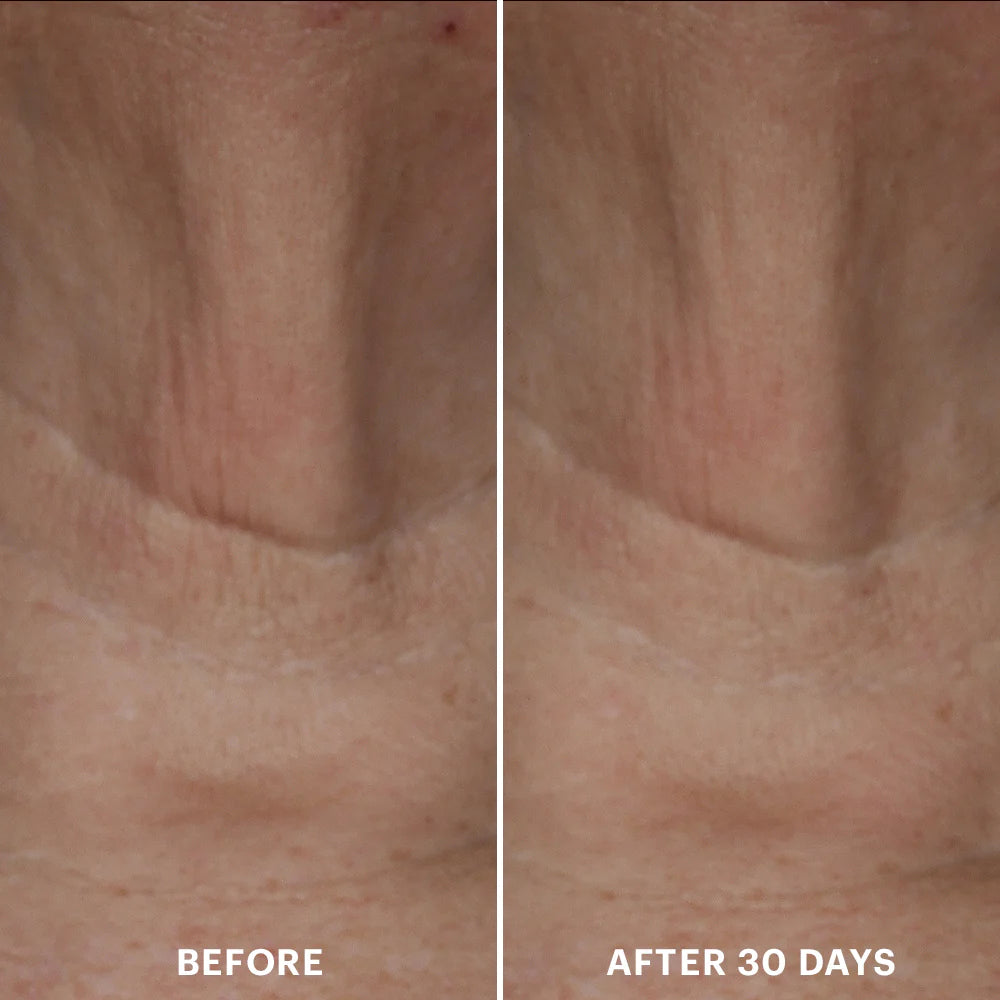 Bio-Renew EGF Neck Cream