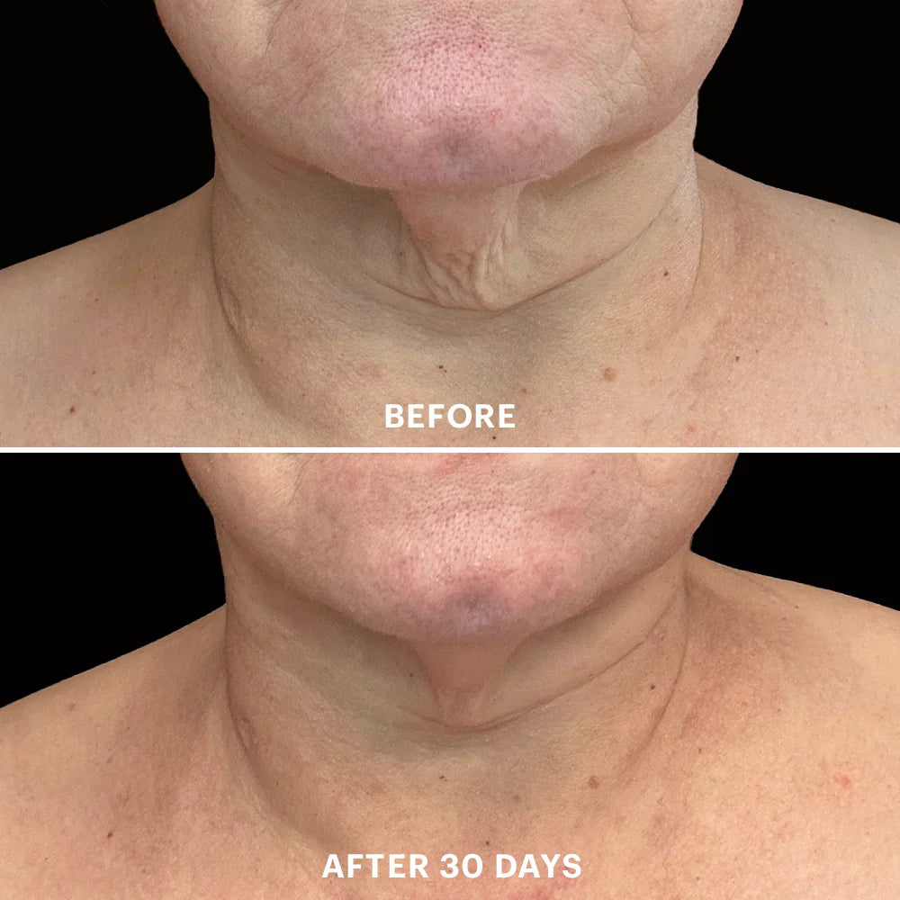 Bio-Renew EGF Neck Cream