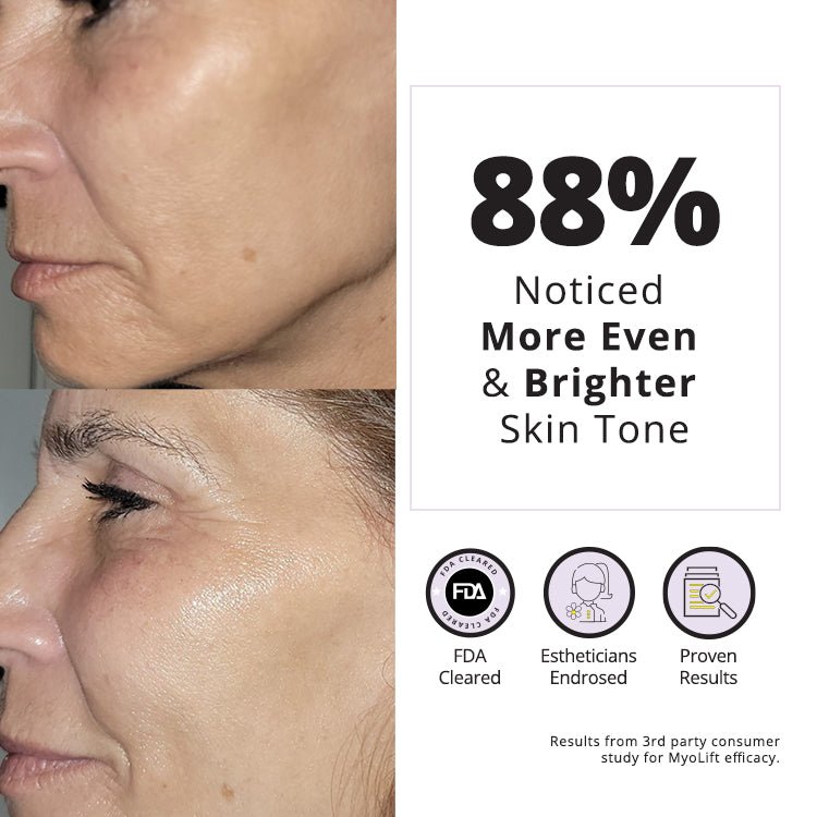 Results showing 88% noticed more even and brighter skin tone after using MyoLift™ Mini Home Care Kit, with FDA clearance and esthetician endorsement